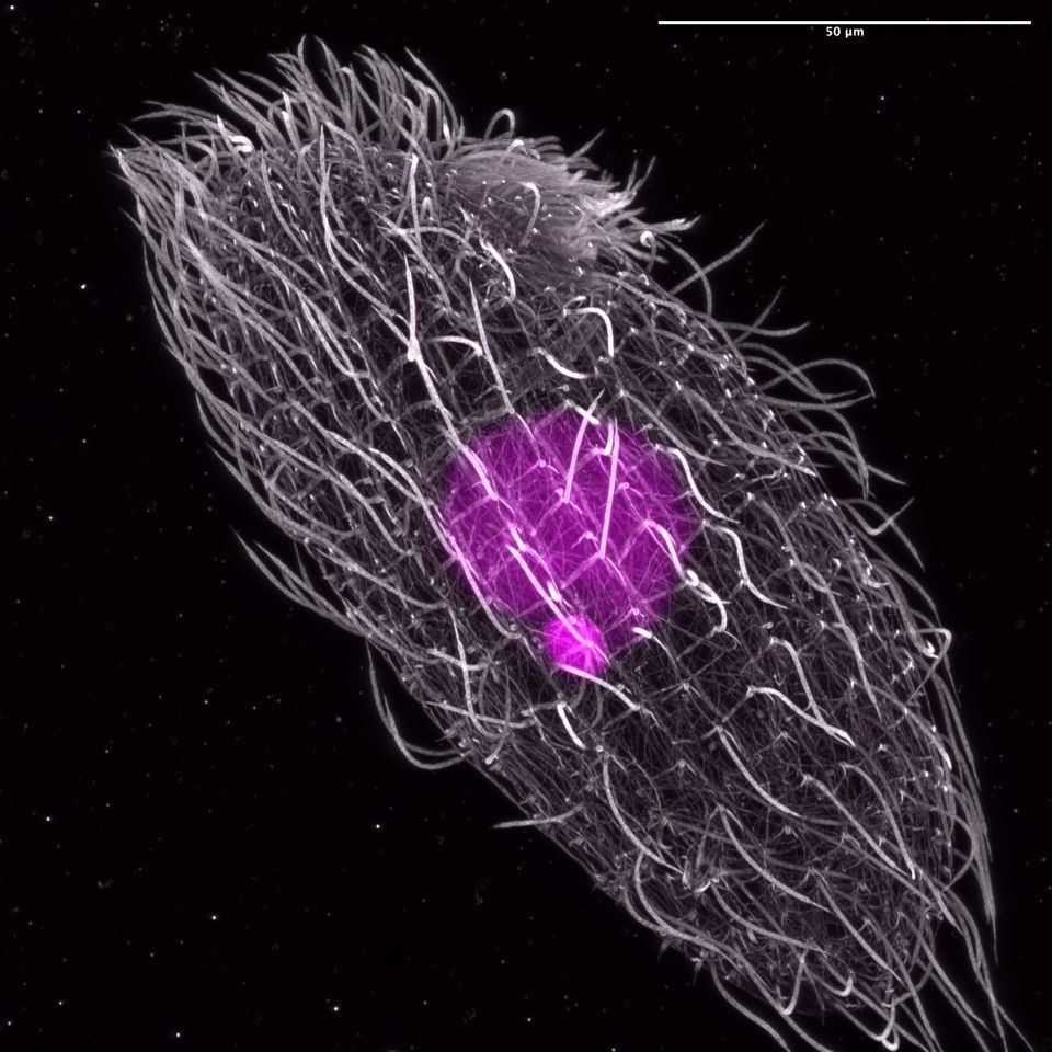 Many of you may be celebrating Easter—if so, happy Easter! 🐣🐰 

For today’s #MidweekMicrobe, we’ll go egg hunting with a model organism in biomedicine—a well-known star behind two Nobel-winning discoveries—the ciliate Tetrahymena thermophila!

📷 Felix Mikus