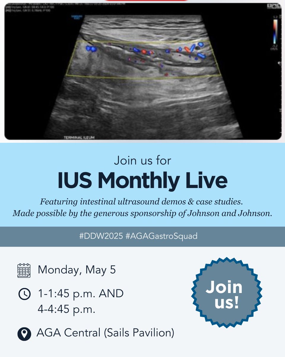 American Gastroenterological Association (AGA) (@amergastroassn) on Twitter photo Your guide to AGA at DDW is here!
If you’re in clinical practice, don’t miss our top events at AGA Central (📍 Sails Pavilion) to help you improve patient care. Get details and add these to your #DDW2025 schedule. ow.ly/Gb6C50VBVtp <a href="/DDWMeeting/">Digestive Disease Week</a> Your guide to AGA at DDW is here!
If you’re in clinical practice, don’t miss our top events at AGA Central (📍 Sails Pavilion) to help you improve patient care. Get details and add these to your #DDW2025 schedule. ow.ly/Gb6C50VBVtp <a href="/DDWMeeting/">Digestive Disease Week</a>