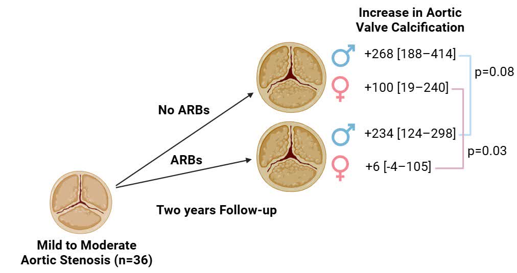 CircImaging (@circimaging) on Twitter photo Angiotensin receptor blockers reduced aortic valve calcification (#yesCT) progression in patients with moderate aortic stenosis and hypertension <a href="/ClavelLabo/">Labo Dr Clavel</a> <a href="/PPibarot/">Philippe Pibarot</a> <a href="/universitelaval/">Université Laval</a> <a href="/IUCPQ/">IUCPQ-ULaval</a> #AHAJournals ahajrnls.org/4jovR9W Angiotensin receptor blockers reduced aortic valve calcification (#yesCT) progression in patients with moderate aortic stenosis and hypertension <a href="/ClavelLabo/">Labo Dr Clavel</a> <a href="/PPibarot/">Philippe Pibarot</a> <a href="/universitelaval/">Université Laval</a> <a href="/IUCPQ/">IUCPQ-ULaval</a> #AHAJournals ahajrnls.org/4jovR9W