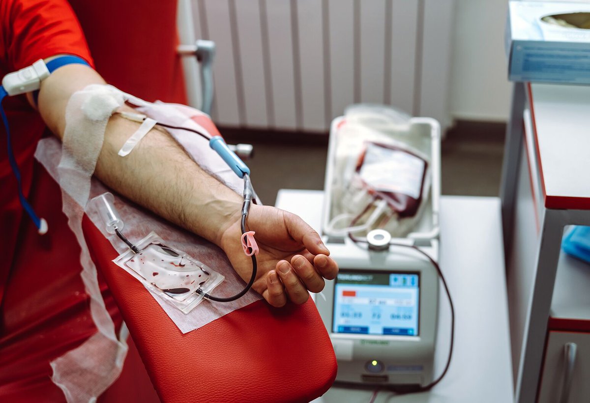 Outdoctrination's tweet photo. The benefits of BLOODLETTING are crazy.

⇢ Anti-aging (reduces all cause mortality)
⇢ Cuts heart disease (by >65%)
⇢ Slashes cancer risk (by ~35%)
⇢ Reduces cancer mortality
⇢ Prevents liver damage
⇢ Lowers blood pressure
⇢ Improves insulin resistance

In people with iron overload.

Some symptoms of iron overload:

➜ Dark circles under eyes
➜ Fatigue
➜ Joint pain
➜ Low libido
➜ Organ damage

Checking a full iron panel (CBC, TIBC, Ferritin, Transferin + % sat, serum iron) and seeing if you're high iron (especially high ferritin) is key to make sure you would benefit.