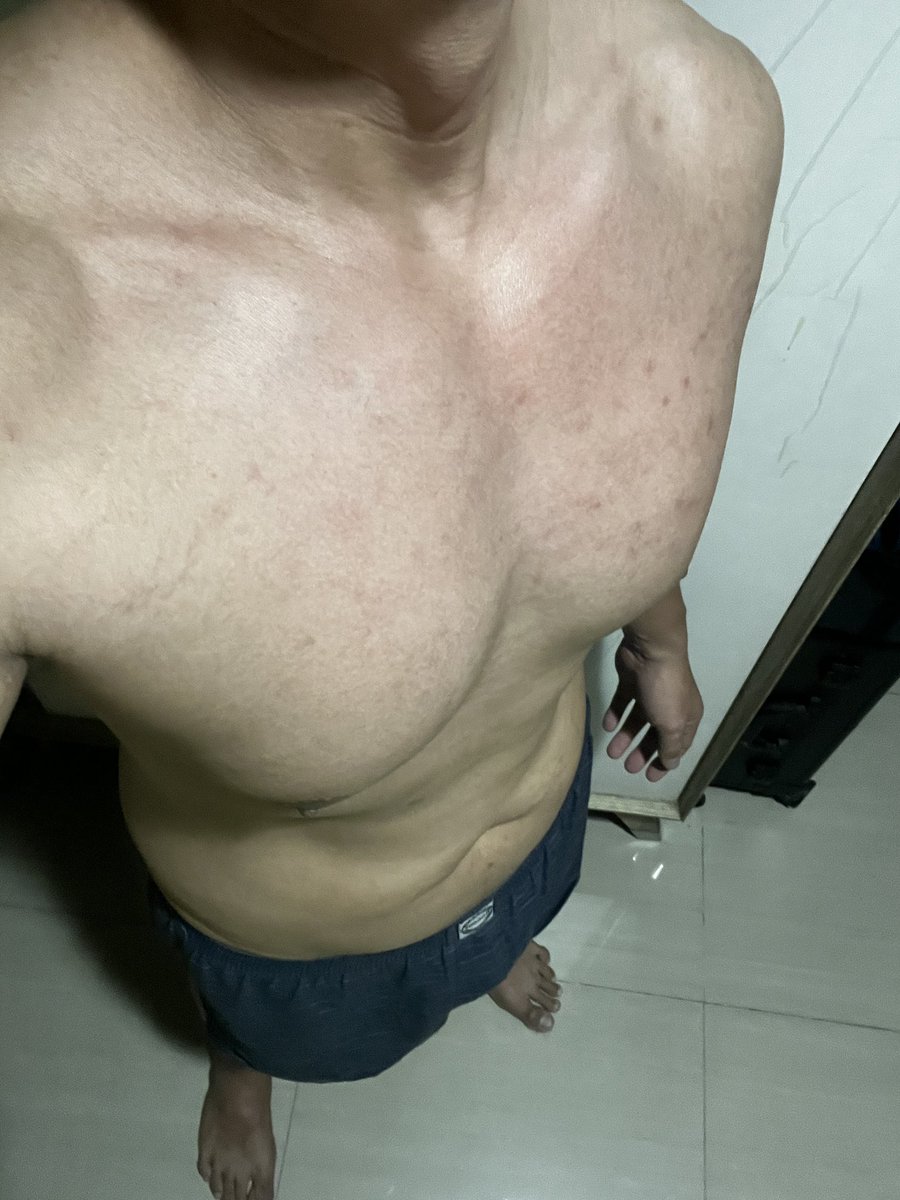 kalajengkinghitam ♏️ (@whateverdehyooo) on Twitter photo after 100 reps of push ups after 100 reps of push ups