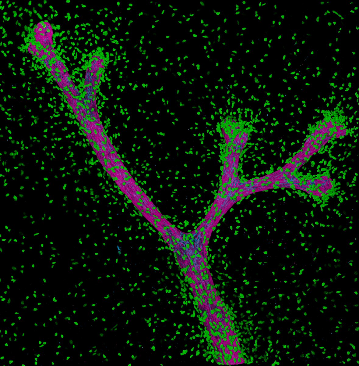 WEHI (Walter and Eliza Hall Institute) (@wehi_research) on Twitter photo New research: analysis of 45,000 healthy and cancerous mouse fibroblasts. Hedgehog pathway changing cells over time, Wnt9a causing senescence in cancer-associated fibroblasts. Led by Dr <a href="/RiustPascual/">Rosa Pascual</a>, Prof Jane Visvader and team in <a href="/embojournal/">The EMBO Journal</a>.
š embopress.org/doi/full/10.10⦠New research: analysis of 45,000 healthy and cancerous mouse fibroblasts. Hedgehog pathway changing cells over time, Wnt9a causing senescence in cancer-associated fibroblasts. Led by Dr <a href="/RiustPascual/">Rosa Pascual</a>, Prof Jane Visvader and team in <a href="/embojournal/">The EMBO Journal</a>.
š embopress.org/doi/full/10.10ā¦