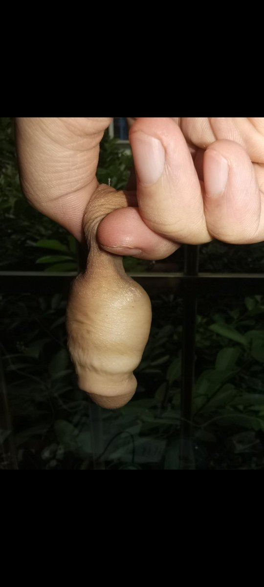 darfinto's tweet photo. cut penis https://t.co/z0fYpCyy5n