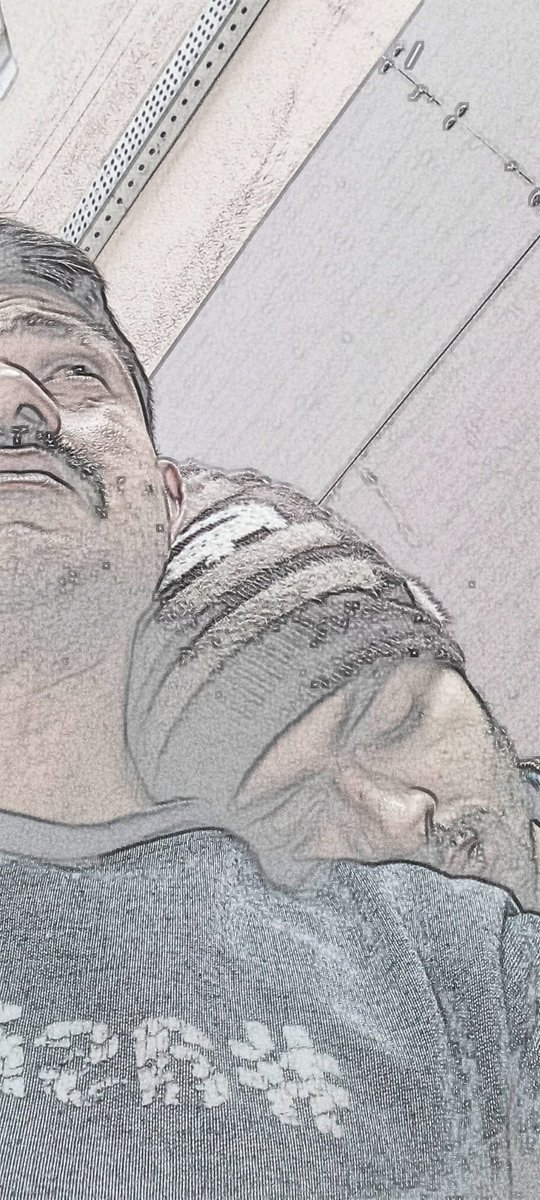 Sohrab_eagleeye's tweet image. #ईगल_मैन🦅 
मैंने सदैव निस्वार्थ भाव से पक्षियों कि सेवा की। मैंने कभी यह नहीं सोचा था कि यही पक्षी मेरे भाई की मृत्यु का कारण बन जाएंगे। यह मेरे जीवन का सबसे बुरा अनुभव था।
#Cryptococcus 🦠  #Brain_dead