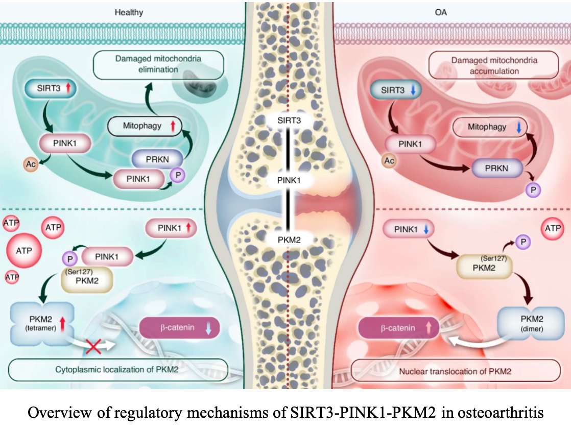 Bone Research_Editorial Office (@boneres_office) on Twitter photo Fixing cell energy centers through the SIRT3–PINK1–PKM2 pathway helps protect joints and improve movement in osteoarthritis by removing damaged parts and helping cells produce energy!🧐
#cell #osteoarthritis #bone
<a href="/BoneRes_Office/">Bone Research_Editorial Office</a>
nature.com/articles/s4141… Fixing cell energy centers through the SIRT3–PINK1–PKM2 pathway helps protect joints and improve movement in osteoarthritis by removing damaged parts and helping cells produce energy!🧐
#cell #osteoarthritis #bone
<a href="/BoneRes_Office/">Bone Research_Editorial Office</a>
nature.com/articles/s4141…