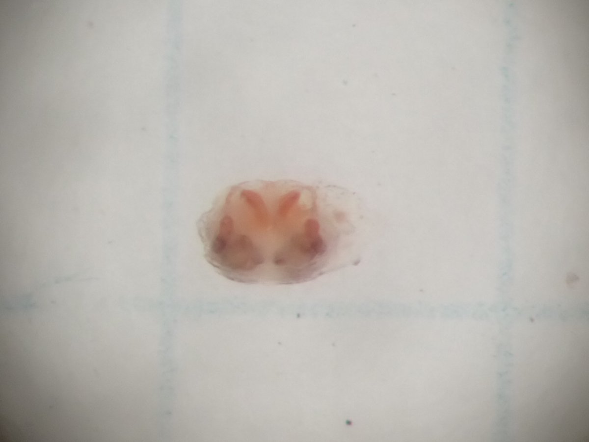 spi_HUMS's tweet photo. おそらくマルオチバカニグモ Ozyptila fukushimai https://t.co/WVBsm69PJI