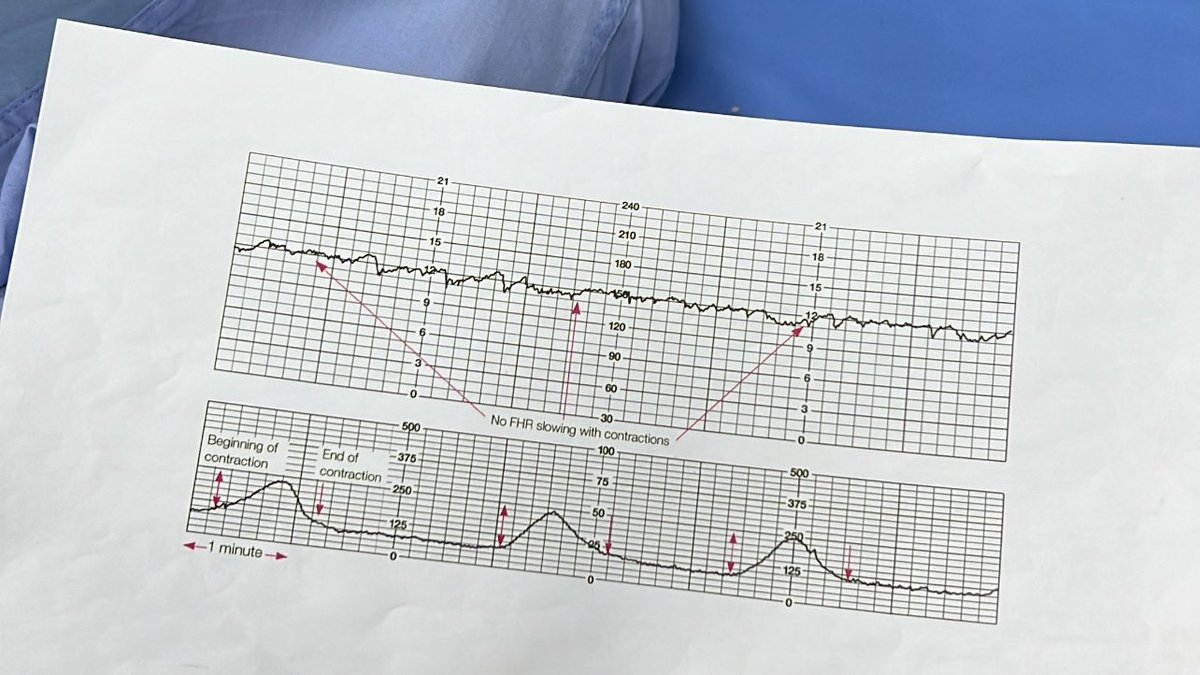 llijn5's tweet image. —Randoms lately