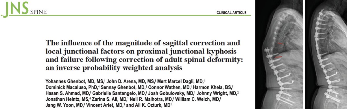 Yohannes Ghenbot (@ghenbot_md) on Twitter photo In our institutional deformity experience, we found unique risk factors for PJK vs PJF. Glad to share our results that contribute to the growing PJK/F literature to inform targeted interventions and enhance outcomes in complex spine surgery <a href="/PennNSG/">Penn Neurosurgery</a>
doi.org/10.3171/2024.1… In our institutional deformity experience, we found unique risk factors for PJK vs PJF. Glad to share our results that contribute to the growing PJK/F literature to inform targeted interventions and enhance outcomes in complex spine surgery <a href="/PennNSG/">Penn Neurosurgery</a>
doi.org/10.3171/2024.1…
