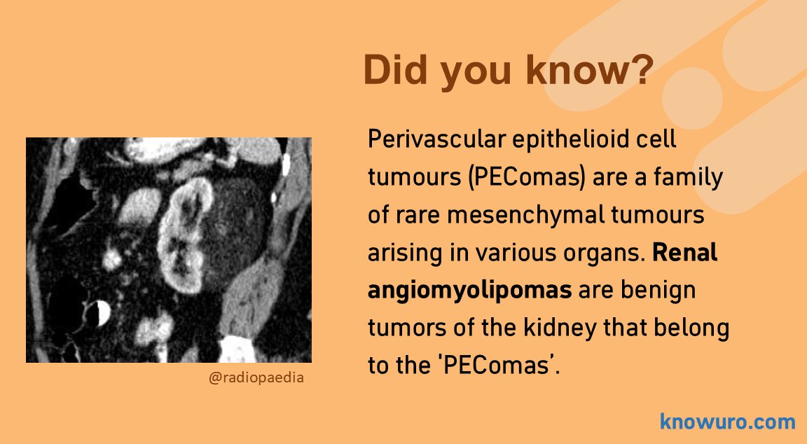 📣 Hello, hello!
We’re back on track after diving deep into our books! 📚
✅ Urology Unboxed is heading to print
✅ The Last Review 25 is getting a fresh update with the latest guidelines

We’ve missed sharing our “Did you know?” #urofacts—so here’s one for you👇