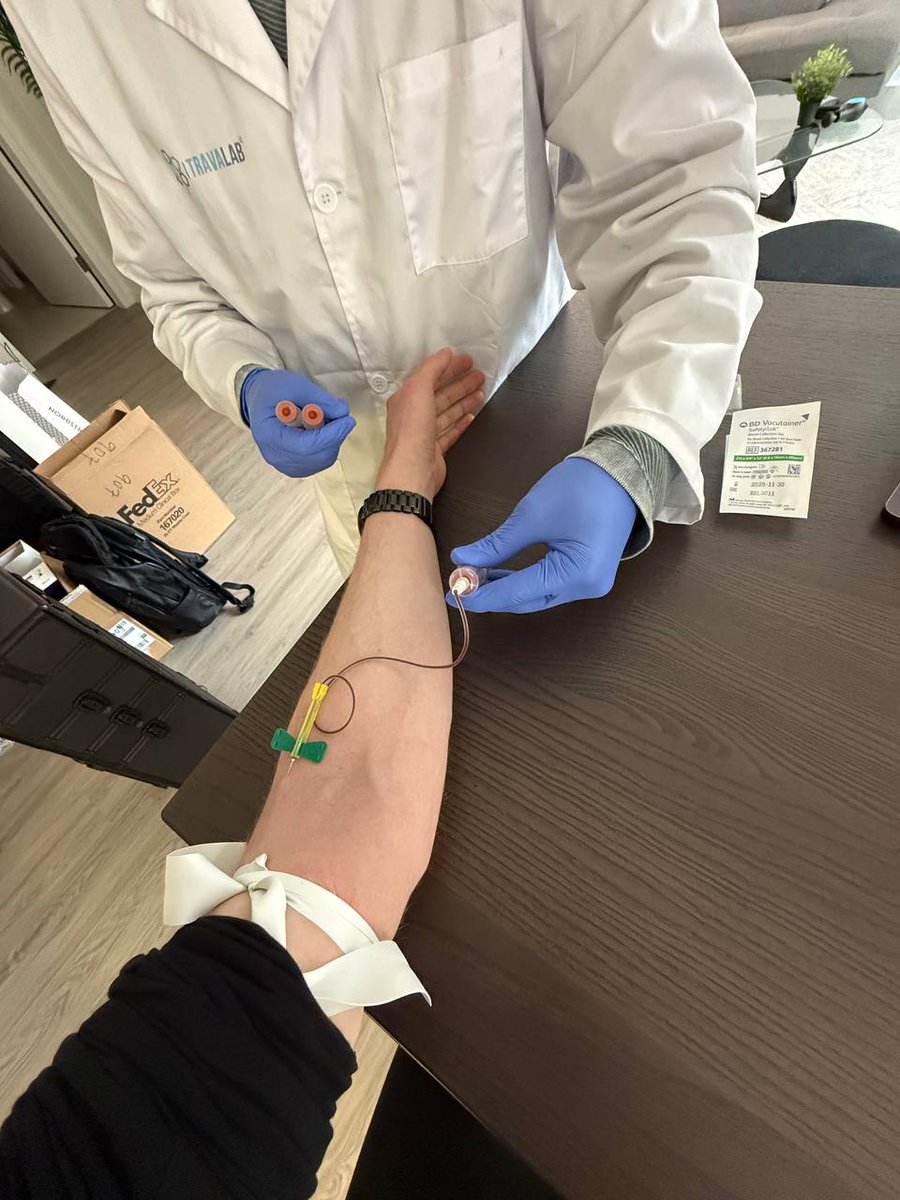 longcovidlabs's tweet photo. 📣 It’s happening. 

The first patient in our case studies got his pre-treatment blood work done this week!     

We sent a mobile phlebotomist to his home to collect the sample, saving him the trip to the lab.  We know how difficult it can be for very severe home- and bedbound patients to make it to a medical facility.  

So we designed our protocol to be as easy for patients as possible.

Patient #1’s blood will be sent off to our laboratory facility in southern California. 

We’ll be running several tests on it - including transcriptomics, a cutting-edge technique that we believe holds huge potential for detecting persistence of the SARS-Cov-2 virus. 🦠 

The persistence of the SARS-Cov-2 virus is what we believe to be the leading hypothesis for the root cause of Long COVID.  Treating this chronic infection is what cured our founder @rd108, and we believe this could be the answer for so many suffering. ❤️‍🩹

The transcriptomics test will allow us to quantify SARS-Cov-2 RNA and the associated inflammatory gene signatures in blood. 

 This means we’re measuring both signs of the virus itself, as well as changes in the patient’s immune response that would show the virus is still there.  

We’ll be measuring these markers before and after treatment, and we expect the abnormal markers will begin to return to normal, if the treatment is successful! ✨

We’ll also be running additional labs, both for the purposes of safety monitoring, as well as to see if we can validate some of the existing research that’s been done on Long COVID biomarkers.  (More info on that to come!). 

Our team is incredibly excited to finally get these biomarker tests up and running!  

Patient #1 will be receiving his treatment next week.

We can’t wait to see where things go!  ✨🙏 🌍