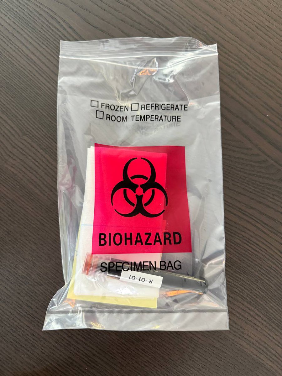 longcovidlabs's tweet photo. 📣 It’s happening. 

The first patient in our case studies got his pre-treatment blood work done this week!     

We sent a mobile phlebotomist to his home to collect the sample, saving him the trip to the lab.  We know how difficult it can be for very severe home- and bedbound patients to make it to a medical facility.  

So we designed our protocol to be as easy for patients as possible.

Patient #1’s blood will be sent off to our laboratory facility in southern California. 

We’ll be running several tests on it - including transcriptomics, a cutting-edge technique that we believe holds huge potential for detecting persistence of the SARS-Cov-2 virus. 🦠 

The persistence of the SARS-Cov-2 virus is what we believe to be the leading hypothesis for the root cause of Long COVID.  Treating this chronic infection is what cured our founder @rd108, and we believe this could be the answer for so many suffering. ❤️‍🩹

The transcriptomics test will allow us to quantify SARS-Cov-2 RNA and the associated inflammatory gene signatures in blood. 

 This means we’re measuring both signs of the virus itself, as well as changes in the patient’s immune response that would show the virus is still there.  

We’ll be measuring these markers before and after treatment, and we expect the abnormal markers will begin to return to normal, if the treatment is successful! ✨

We’ll also be running additional labs, both for the purposes of safety monitoring, as well as to see if we can validate some of the existing research that’s been done on Long COVID biomarkers.  (More info on that to come!). 

Our team is incredibly excited to finally get these biomarker tests up and running!  

Patient #1 will be receiving his treatment next week.

We can’t wait to see where things go!  ✨🙏 🌍