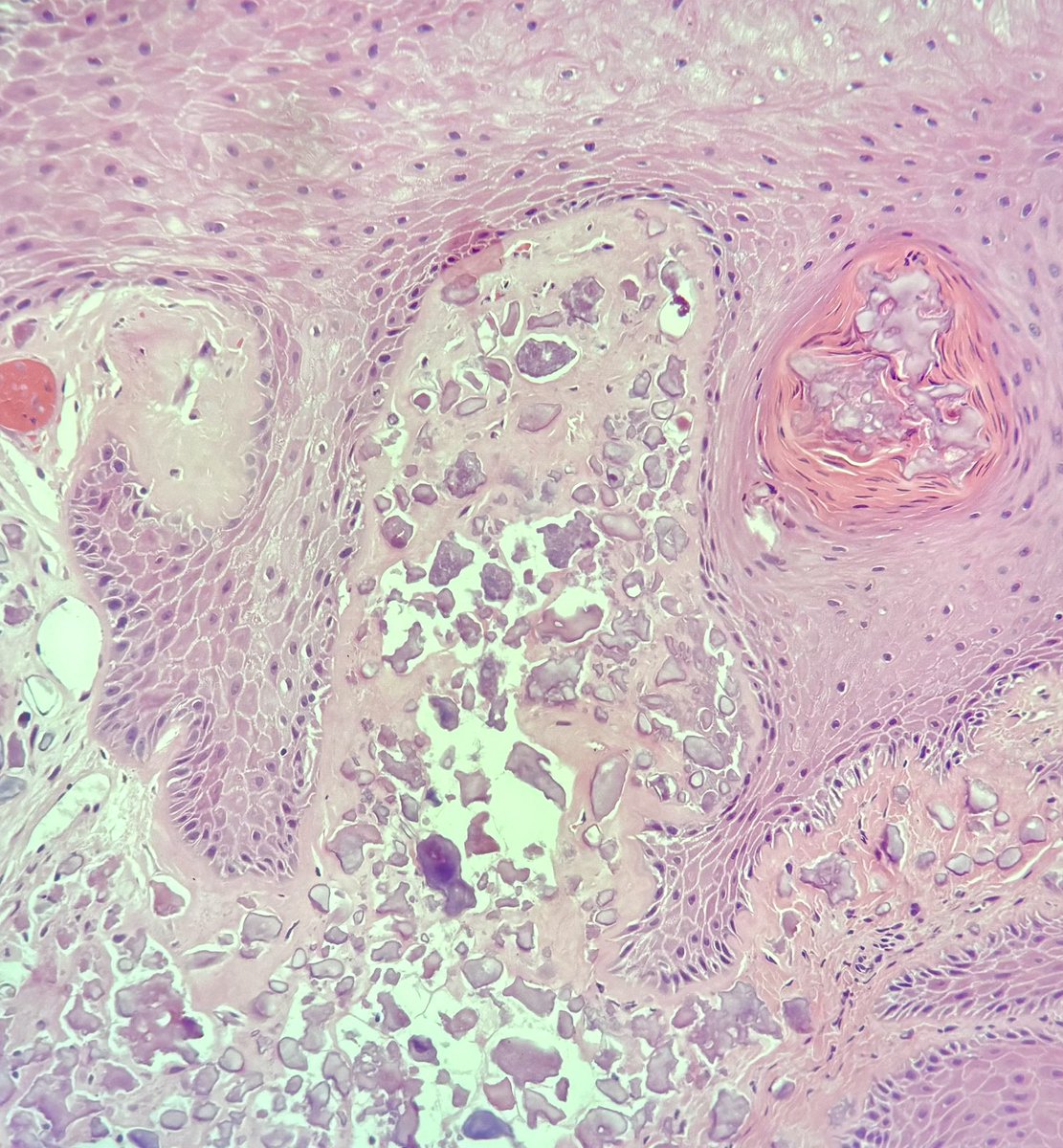 Francesco Fortarezza tweet media