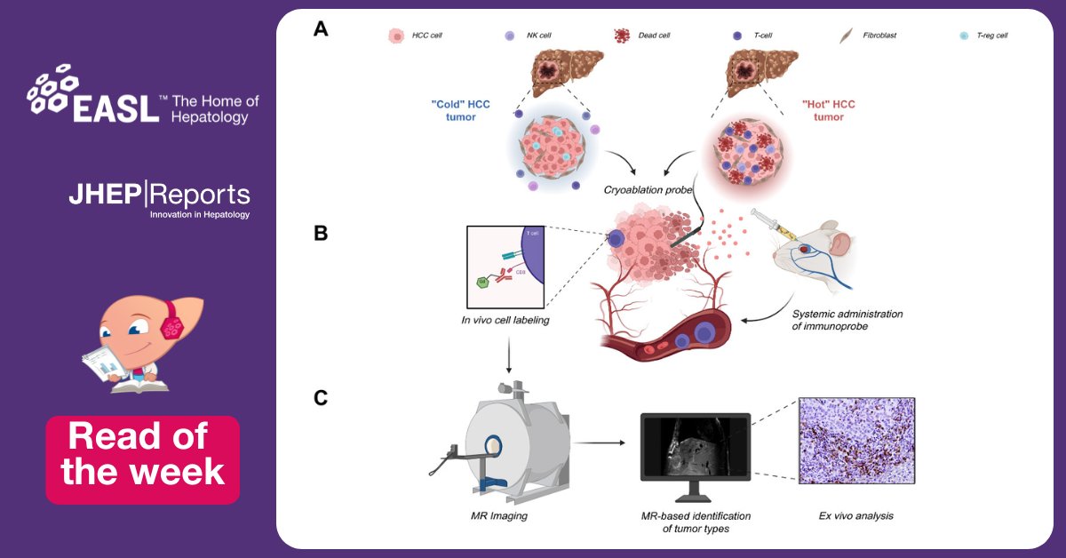 EASLnews (@easlnews) on Twitter photo Today’s #readoftheweek📚 discusses the potential of pCryo as an immunomodulatory therapy in #HCC.
Read here this <a href="/JHEP_Reports/">JHEP Reports</a> article: jhep-reports.eu/article/S2589-…
🙏 <a href="/LShewarega/">Annabella Shewarega</a> <a href="/dcmadoff/">David C. Madoff, MD</a> <a href="/JuliusChapiro/">Julius Chapiro</a> et al.
#LiverTwitter #LiverX Today’s #readoftheweek📚 discusses the potential of pCryo as an immunomodulatory therapy in #HCC.
Read here this <a href="/JHEP_Reports/">JHEP Reports</a> article: jhep-reports.eu/article/S2589-…
🙏 <a href="/LShewarega/">Annabella Shewarega</a> <a href="/dcmadoff/">David C. Madoff, MD</a> <a href="/JuliusChapiro/">Julius Chapiro</a> et al.
#LiverTwitter #LiverX