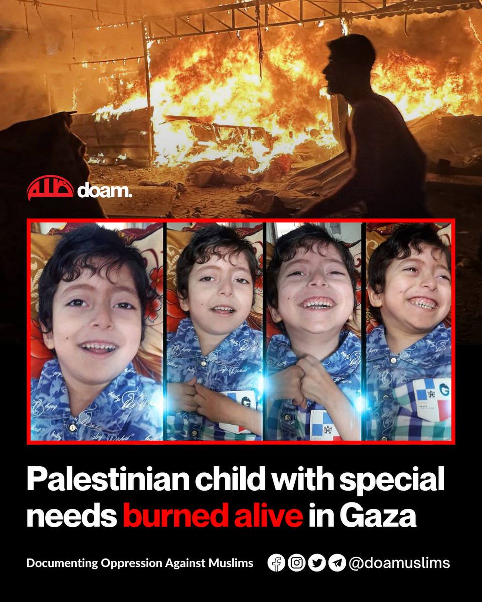 Seorang kanak-kanak Palestin kelainan upaya, Ahmed Abu Al-Rous rentung dibakar hidup-hidup malam tadi selepas pesawat perang Israel mengebom khemah-khemah pelarian di kawasan Al-Mawasi, Khan Younis, Gaza.