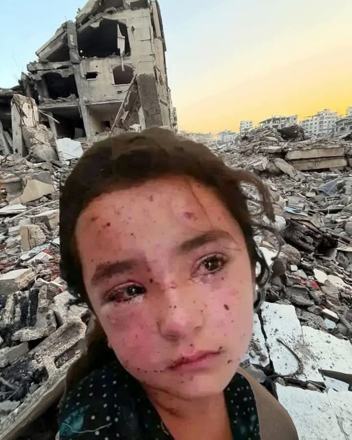 Unfortunately, this is happening in the 21st century.
Part of the world is still ruled by the law of the jungle and one million children are living through horror after horror, every day.
According to UNICEF: “More than 100 children are k.illed or injured daily a due to heavy