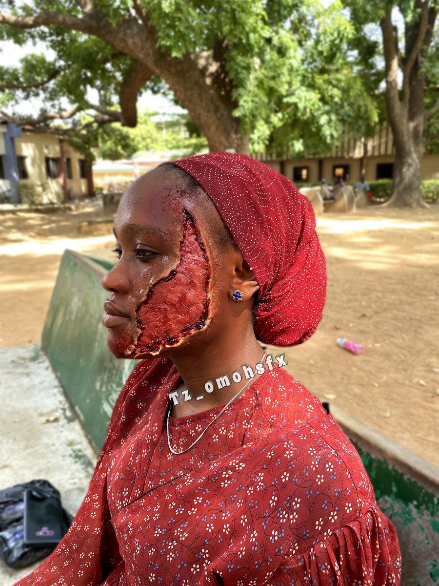 Helo everyone this is a special effect makeup injury I create please drop a comment and tell me how you think I did on this...