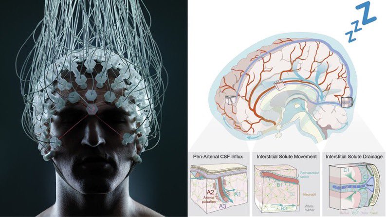 UpRaveTheGood's tweet photo. Sleep isn’t optional. It’s your brain’s survival system.

Neglecting it does more than make you tired —
It destroys your memory, expands fat cells, shrinks your brain, and ages you faster than smoking.

This isn’t a hack.
It’s the most underrated superpower in health.

- Thread - 🧵 

Here’s how to unlock the science of elite-level sleep — and protect your future before it’s too late: