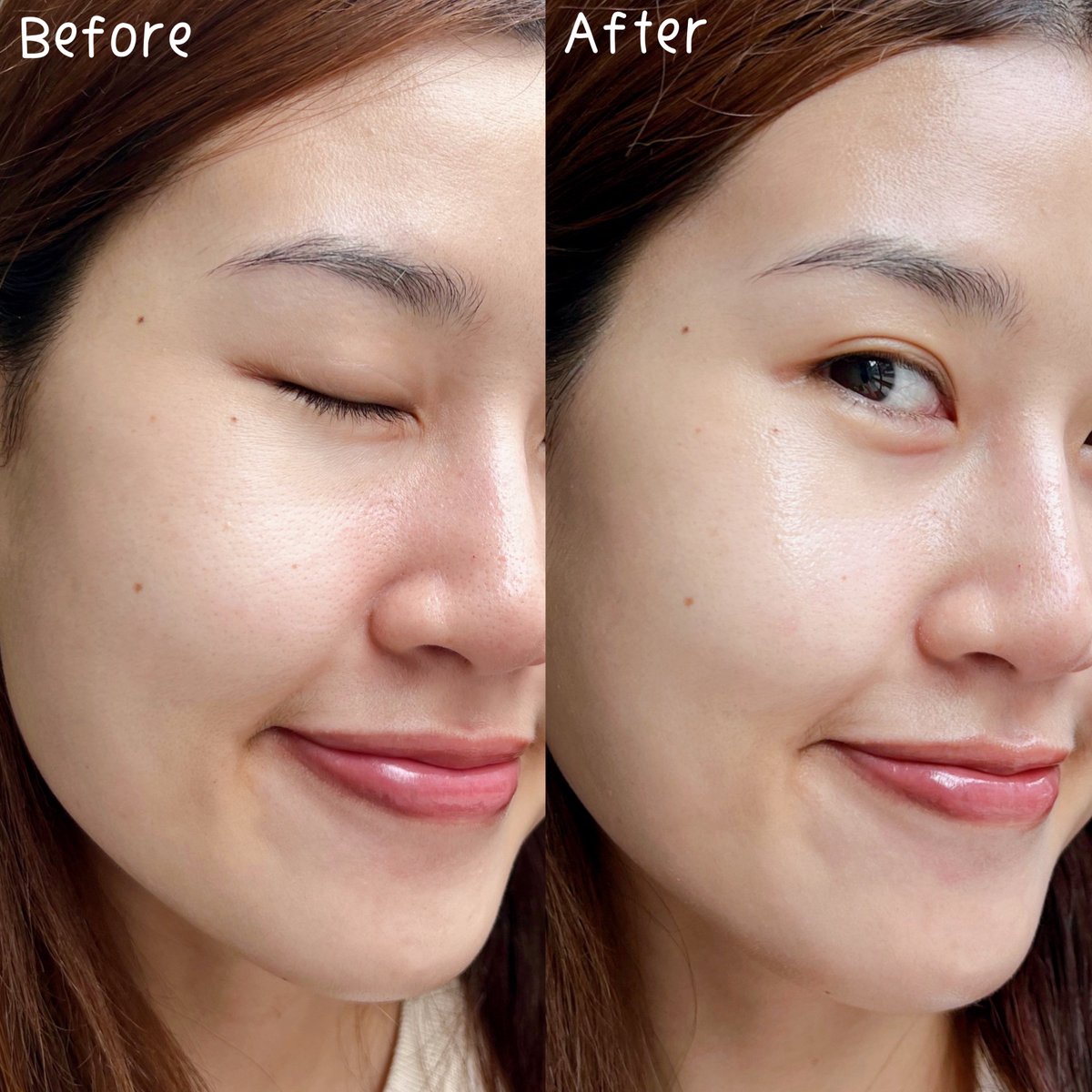 สกินแคร์บำรุงผิวหลังสงกรานต์ ต้องคู่นี้แหละ Glad2Glow bright set กู้ผิวหมองคล้ำจากแดด ดีมาก เซรั่มเนื้อบางเบา 10% Niacinamide ช่วยให้ผิวใสสม่ำเสมอ จุดดำจางลง และครีมมอยส์ 5% Niacinamide ผิวฉ่ำ อิ่มน้ำ ดูสุขภาพดีสุดๆ ใช้คู่นี้ต่อเนื่องผิวยิ่งโกลว์ใสขึ้น ของถูกและดีมีอยู่จริง 💞 https://t.co/FxhdkxlPpX