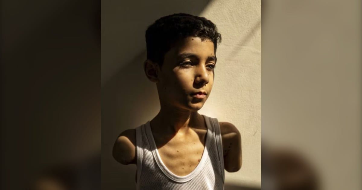 CP24's tweet image. Portrait of Palestinian boy who lost both arms is World Press Photo of the year for 2025 cp24.com/news/world/202…