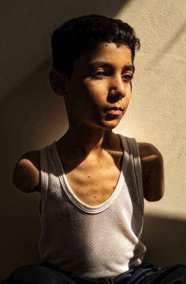 Ali Mete (@alimete82) on Twitter photo (D) Als <a href="/WorldPressPhoto/">World Press Photo</a> 2025 wurde ein Foto des im #Gaza-Krieg verstümmelter palästinensischen Jungen Mahmoud Ajjour gewählt. Die Fotografin Samar Abu Elouf fotografierte den neunjährigen Mahmoud, der im März 2024 auf der Flucht vor einem israelischen Angriff so schwer verletzt (D) Als <a href="/WorldPressPhoto/">World Press Photo</a> 2025 wurde ein Foto des im #Gaza-Krieg verstümmelter palästinensischen Jungen Mahmoud Ajjour gewählt. Die Fotografin Samar Abu Elouf fotografierte den neunjährigen Mahmoud, der im März 2024 auf der Flucht vor einem israelischen Angriff so schwer verletzt