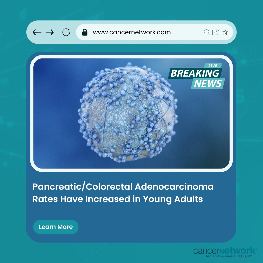 CancerNetwrk's tweet photo. The incidence of pancreatic and colorectal adenocarcinoma has increased among young adults, highlighting a need for heightened awareness of this trend when evaluating younger patients with possible symptoms. #pancsm | @arvind_trindade

https://t.co/GIYymjBGvX https://t.co/YeRjNxxt1O