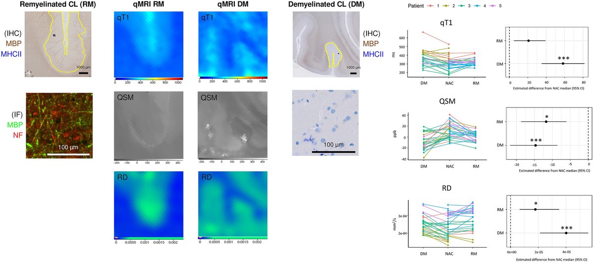 brainpathol's tweet image. Quantitative T1 is sensitive to cortical remyelination in multiple sclerosis: A postmortem MRI study
onlinelibrary.wiley.com/doi/10.1111/bp…