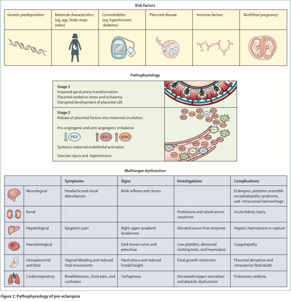AmbrizMau's tweet photo. Preeclampsia.

Lancet 2021; DOI: https://t.co/ucU0NTNmtd https://t.co/sM19A9xXNx
