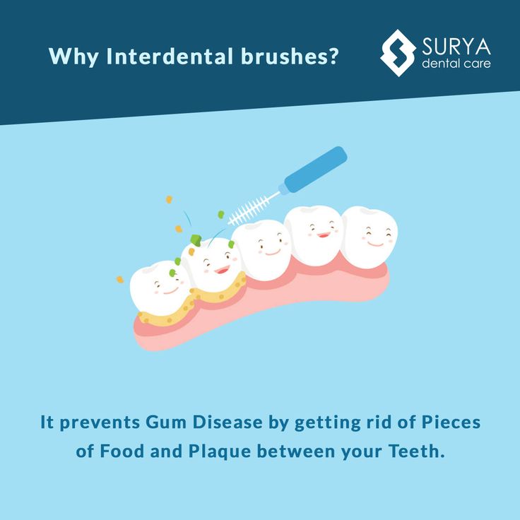 KitsFamDental's tweet image. #Dentaltip Do you recognize this little tool? It's called the interdental toothbrush.  It works like a floss and a toothbrush at the same time.  #teeth #crackedteeth #ice #toothloss #dentalhygiene #dentalcare #oralcare #oralhygiene #dentists #vancouverdentists #dentalhygiene