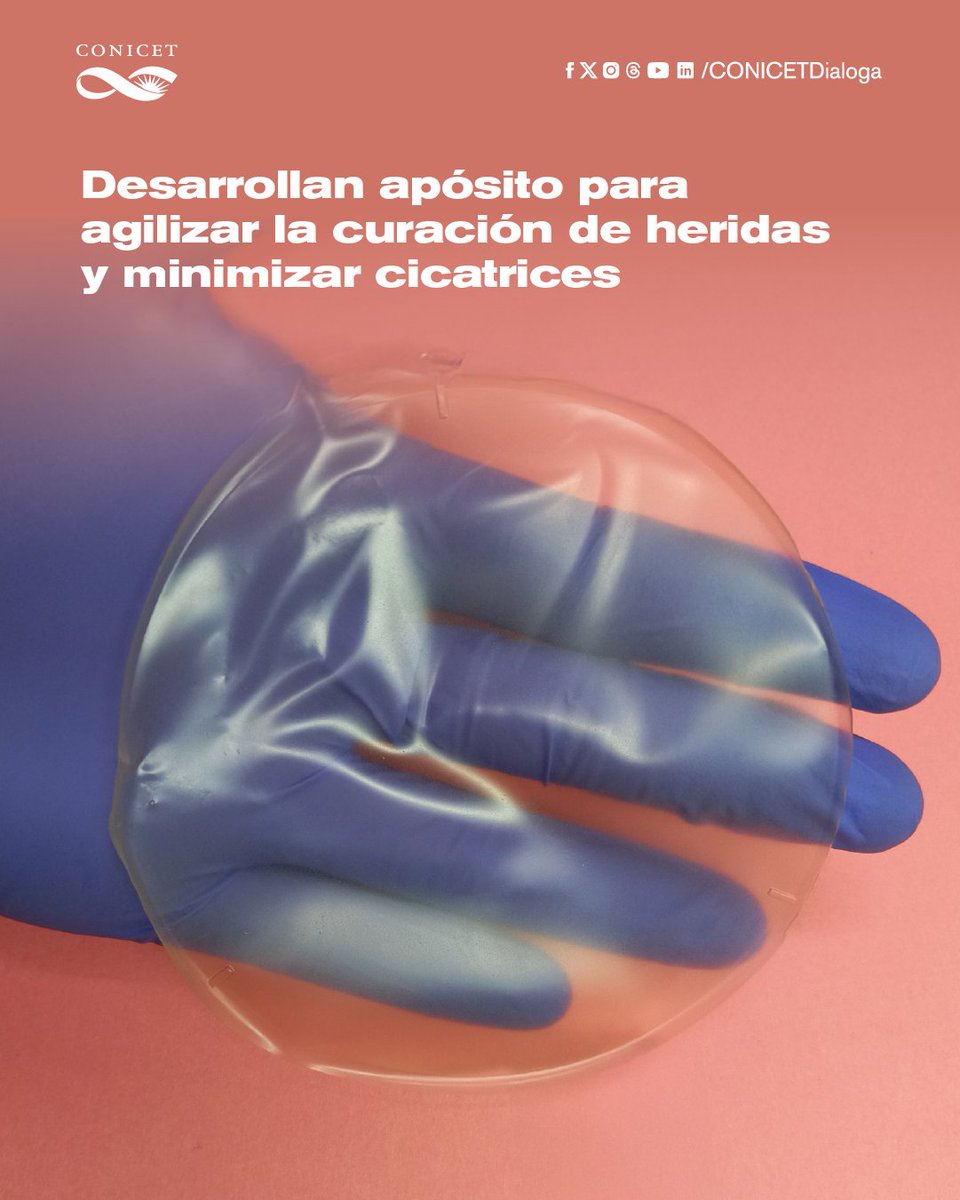 🟢Especialistas del CONICET desarrollaron un apósito para el tratamiento de heridas que no solo previene infecciones y permite que la piel respire, sino que además participa activamente en la curación. El producto demostró ser seguro y eficaz en estudios in vitro.