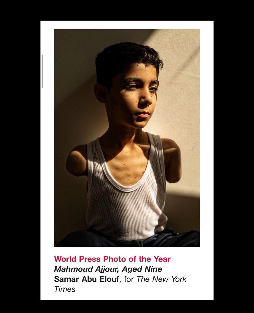 Samar Abu Elouf (@samarabuelouf) on Twitter photo I made it to #the_world_press_photo of the Year 2025
<a href="/nytimes/">The New York Times</a> <a href="/WorldPressPhoto/">World Press Photo</a>
I wish Ihab a speedy recovery and good health. I made it to #the_world_press_photo of the Year 2025
<a href="/nytimes/">The New York Times</a> <a href="/WorldPressPhoto/">World Press Photo</a>
I wish Ihab a speedy recovery and good health.