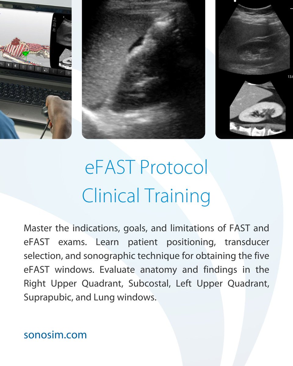 Enhance your emergency ultrasound skills with SonoSim training! Learn how to perform and interpret FAST &amp; eFAST exams with confidence—because in critical situations, every second counts. ⏳💡

#ultrasoundeducation #emergencymedicine #efast