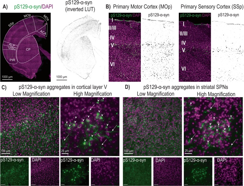 The <a href="/LabMoehle/">Mark Moehle Lab</a> has recently had their manuscript titled "Early A-synuclein aggregation decreases corticostriatal glutamate drive and synapse density" accepted in the Neurobiology of Disease journal.