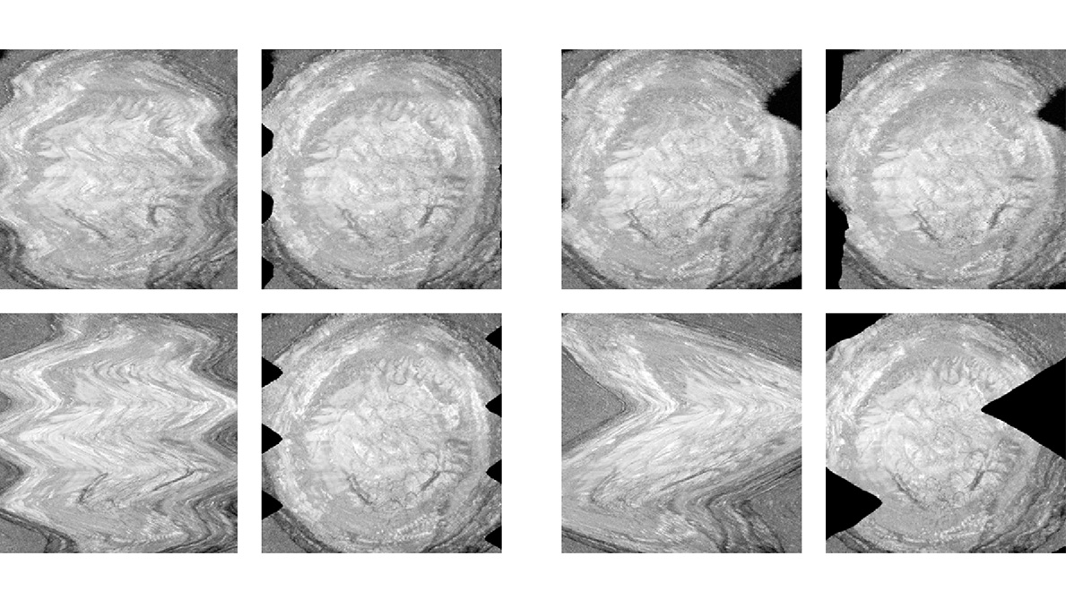 OpticaPubsGroup's tweet image. An Editors&apos; Pick via #OPG_BOEx: Sensor-driven digital motion correction of robotically-aligned optical coherence tomography retinal volumes bit.ly/3YxItmN #RayTracing #ImagingTechniques @DukeU