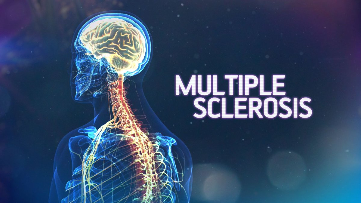 On #scotnight 

🔷 <a href="/selenajackson_/">Selena Jackson</a> hears how teams in Scotland are working to improve lives for those with MS

🔷<a href="/ptupdate/">Pennie Taylor</a>, <a href="/beneragazza/">bene briggs</a> &amp; Brian Taylor are live in studio to reflect on some of the week's big stories.

📺 8:30pm on STV / player.stv.tv