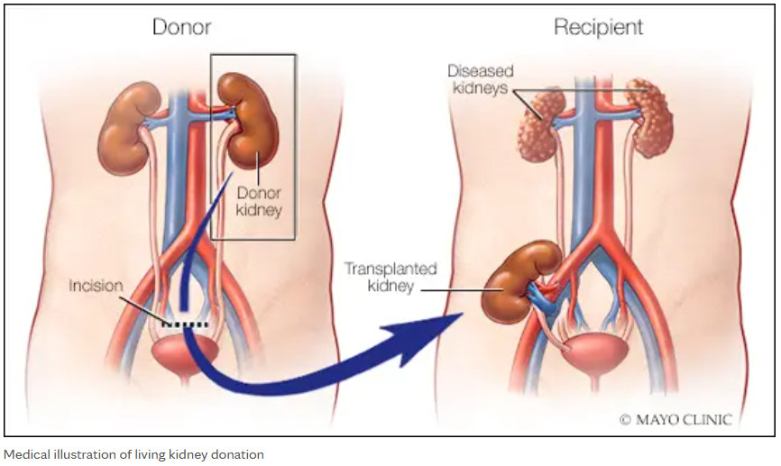 Mayo Clinic Transplantation Surgery (@mctransplntsurg) on Twitter photo RT <a href="/MayoTransplant/">Mayo Clinic Transplant</a>: Becoming an #organdonor is one of the most meaningful decisions you can make, offering the chance to save lives — whether after death or as a #livingdonor. #DonateLife <a href="/JulieHeimbach/">Julie Heimbach</a> mayocl.in/42Khbey RT <a href="/MayoTransplant/">Mayo Clinic Transplant</a>: Becoming an #organdonor is one of the most meaningful decisions you can make, offering the chance to save lives — whether after death or as a #livingdonor. #DonateLife <a href="/JulieHeimbach/">Julie Heimbach</a> mayocl.in/42Khbey