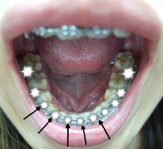 gummy_mk28's tweet photo. この子がね、ストッパーになってて…
一回ここに入り込むともう全っ然取れなくなる！🥺
同じ気持ちわかってくれる人がいたらすごく心強いです！😂 https://t.co/1b02m9m62j
