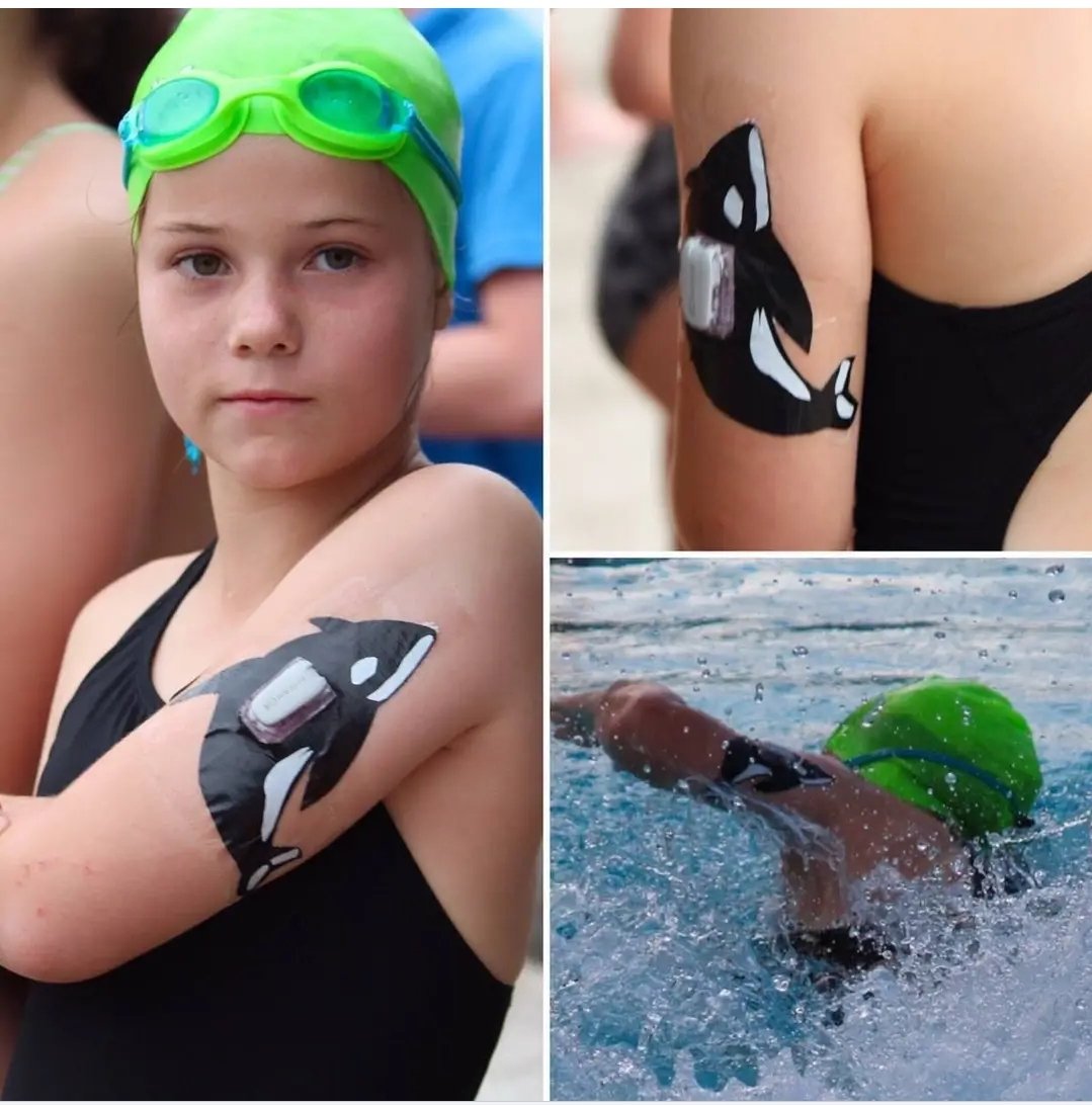 "Dad decorates his daughter's diabetes device for her swim meet with dollar store tape. Her team name is the "killer whales."

It is a device that is able to track blood sugars that is then sent to a small device (size of a pager) where you are able to see your blood sugar levels