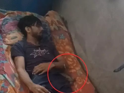 पत्नी ने बॉयफ्रेंड के साथ मिलकर सोते वक्त पति का गला घोंटा, फिर शव के नीचे सांप को दबा दिया। दबे होने पर सांप ने युवक को 10 बार डसा।

वारदात के बाद बॉयफ्रेंड को वहां से भगा दिया गया और खुद दूसरे कमरे में जाकर सोने चली गई। सुबह जब घरवाले उठे तो देखा कि युवक की मौत हो चुकी थी। उसके