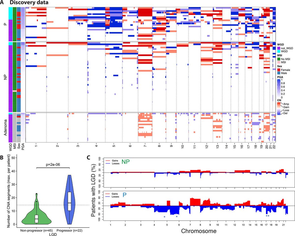 Gut Journal (@gut_bmj) on Twitter photo #GUTImages from the paper by Al Bakir et al on
"Low-coverage whole genome sequencing of low-grade dysplasia strongly predicts advanced neoplasia risk in ulcerative colitis" via
bit.ly/4lx80GU
<a href="/DrPipDunne/">Philip Dunne</a> <a href="/trevoragraham/">Trevor Graham</a> <a href="/yosoykit/">Kit Curtius</a> #UC #LGD #GUTImages from the paper by Al Bakir et al on
"Low-coverage whole genome sequencing of low-grade dysplasia strongly predicts advanced neoplasia risk in ulcerative colitis" via
bit.ly/4lx80GU
<a href="/DrPipDunne/">Philip Dunne</a> <a href="/trevoragraham/">Trevor Graham</a> <a href="/yosoykit/">Kit Curtius</a> #UC #LGD