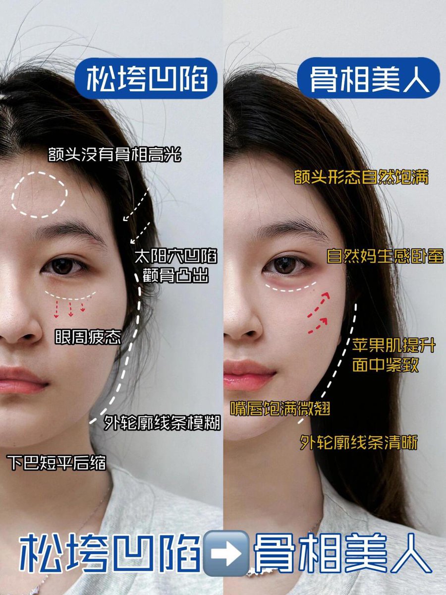 Dr成/美业(@xiaoxiao0373) / Posts / X, image size:900x1200