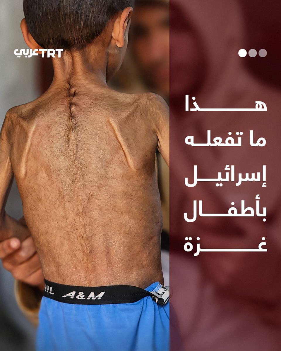 بحصار مطبق على القطاع منذ أشهر.. هذا ما تفعله إسرائيل بأطفال #غزة

ما #تعليقك على هذه القصة