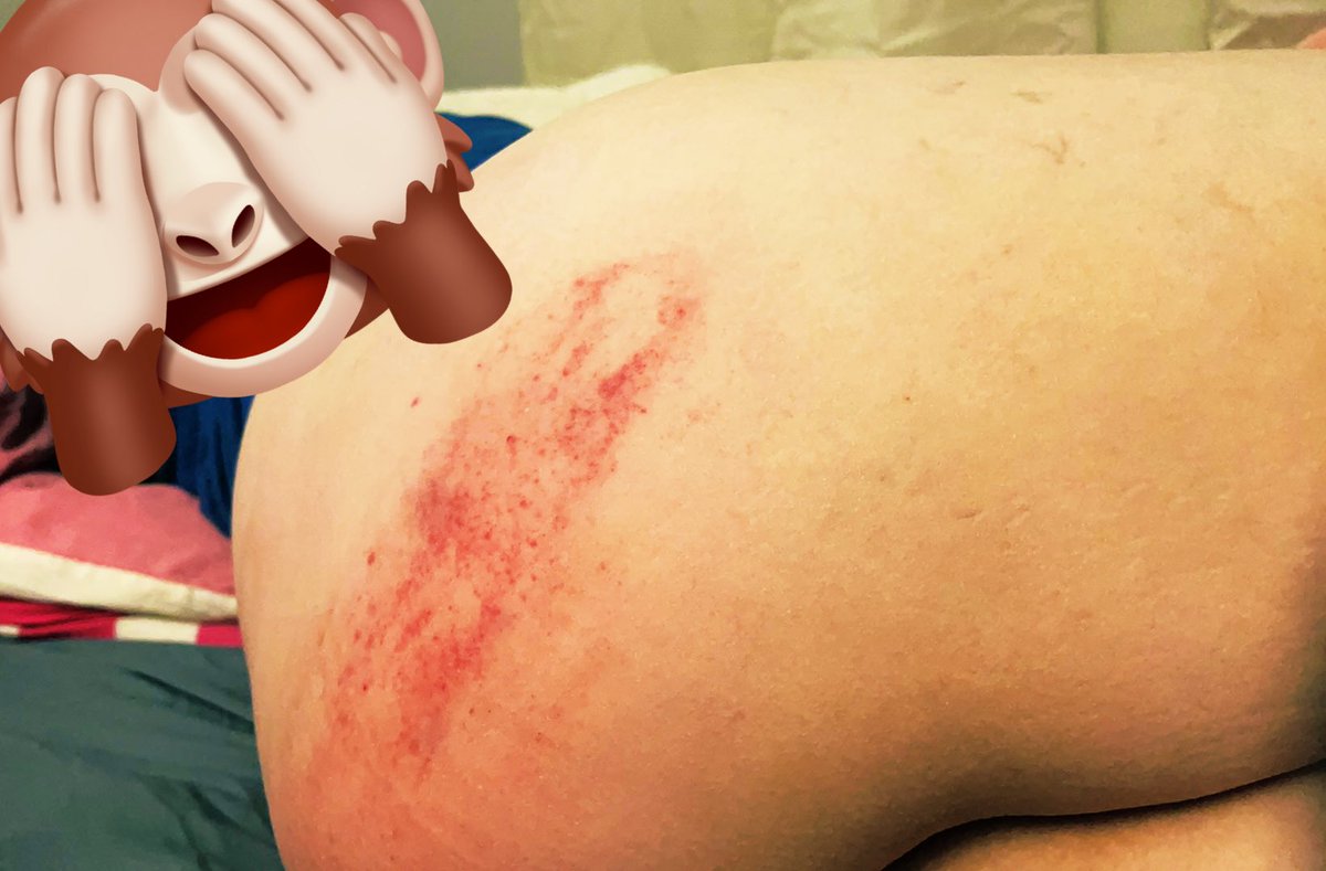 xiaxiaomumu's tweet photo. 痛😣

#痛 #sp #spank #bdsm https://t.co/znvj1VyihQ