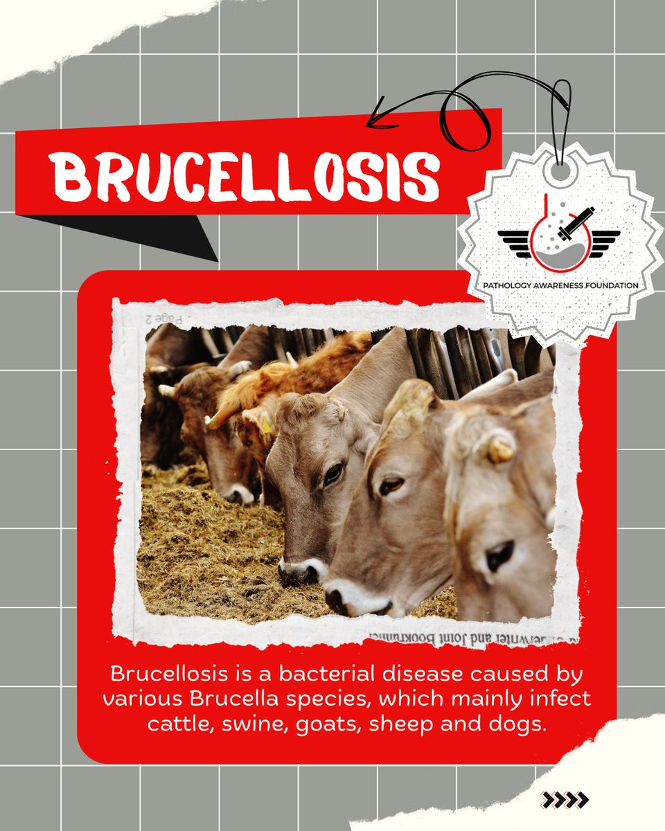 PathologyAware's tweet photo. Breaking the Silence on Brucellosis!

Our Ambassador from Maharashtra Animal and Fishery Sciences University, Nagpur, together with her team members—Team NVC, are spreading awareness on brucellosis—its transmission, symptoms, and impact on public health. https://t.co/ZCL2GR9A8b