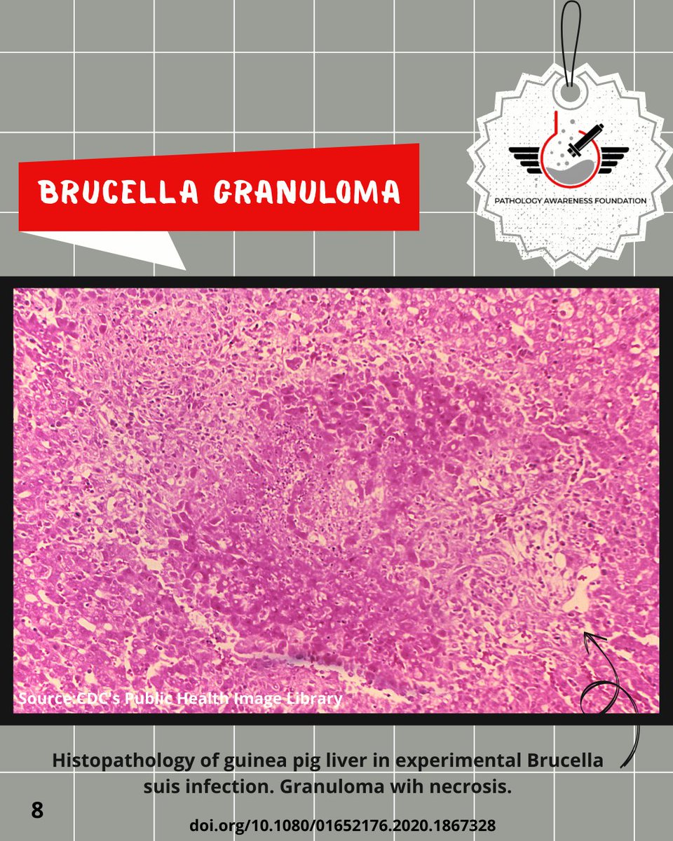 PathologyAware's tweet photo. https://t.co/k57FRBxIR2