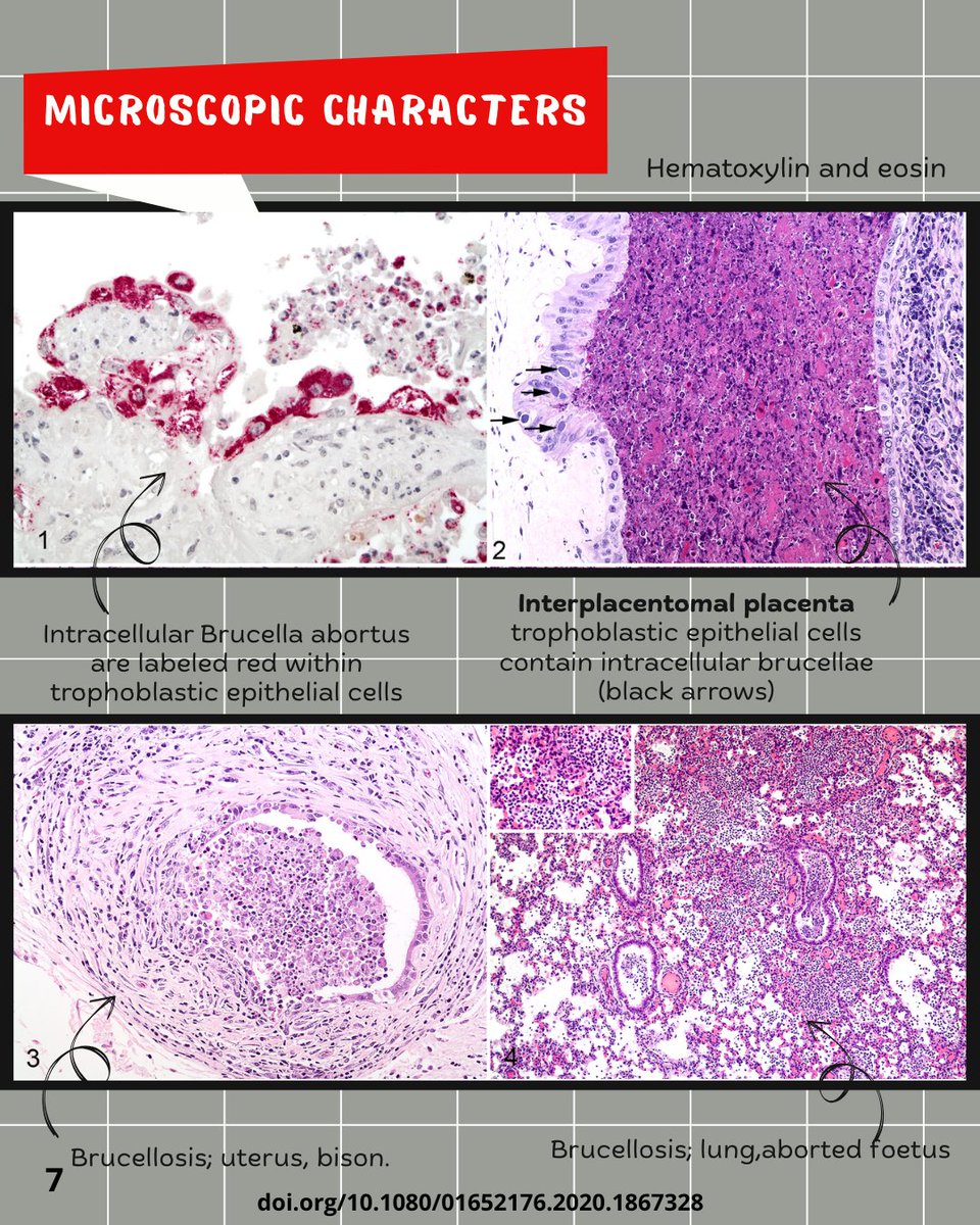 PathologyAware's tweet photo. https://t.co/k57FRBxIR2