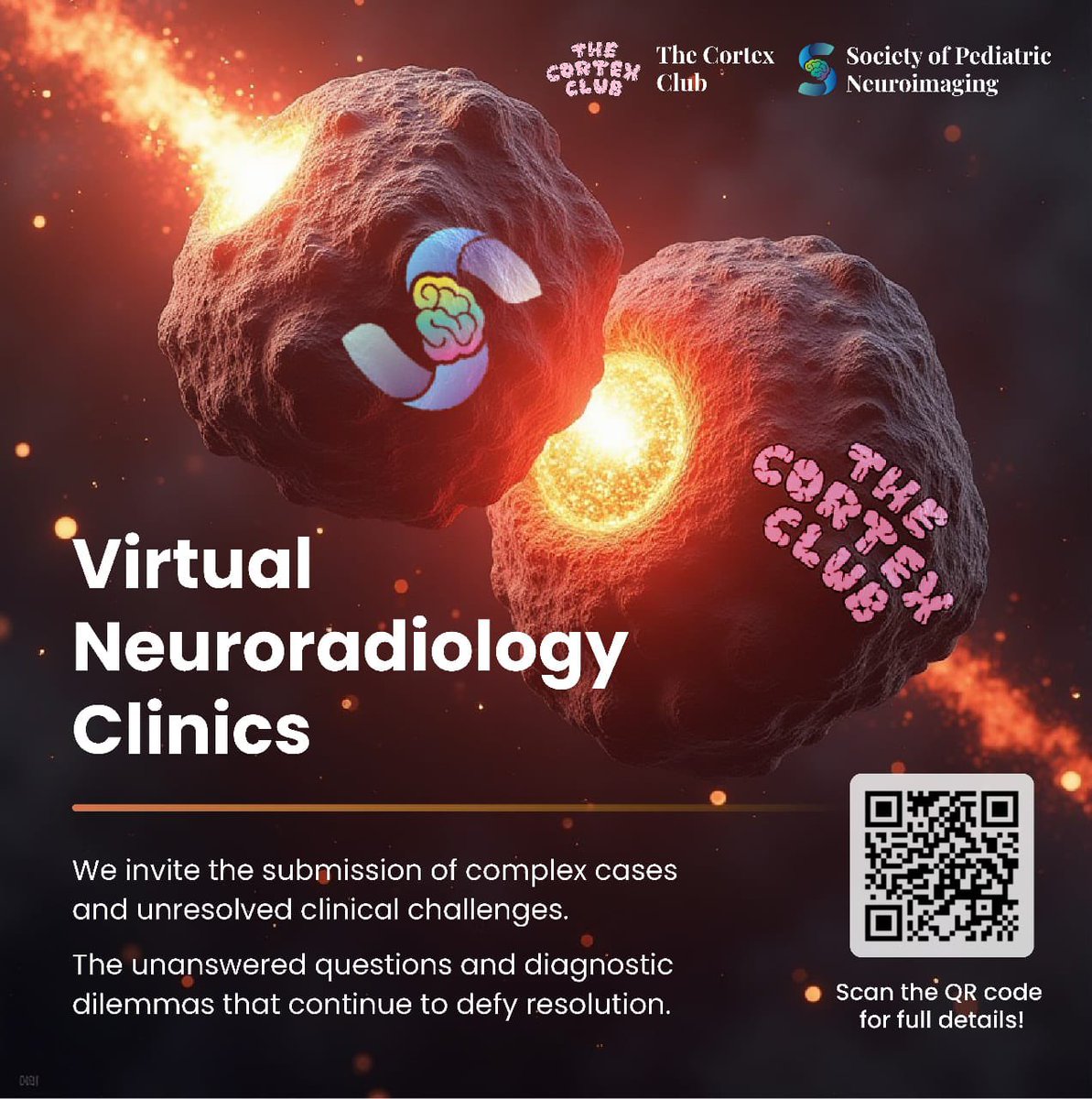 Dr Kish Mankad (@drmankad) on Twitter photo Hoping to meet you all at the first Virtual Neuroradiology Clinic next week- established with the intention of global outreach, and to help clinicians and radiologists with tough cases, brought to you by a symbiosis and synergy between <a href="/spinacademics/">SPIN | Society of Pediatric Neuroimaging</a> and <a href="/thecortexclub/">The Cortex Club</a>. Hoping to meet you all at the first Virtual Neuroradiology Clinic next week- established with the intention of global outreach, and to help clinicians and radiologists with tough cases, brought to you by a symbiosis and synergy between <a href="/spinacademics/">SPIN | Society of Pediatric Neuroimaging</a> and <a href="/thecortexclub/">The Cortex Club</a>.