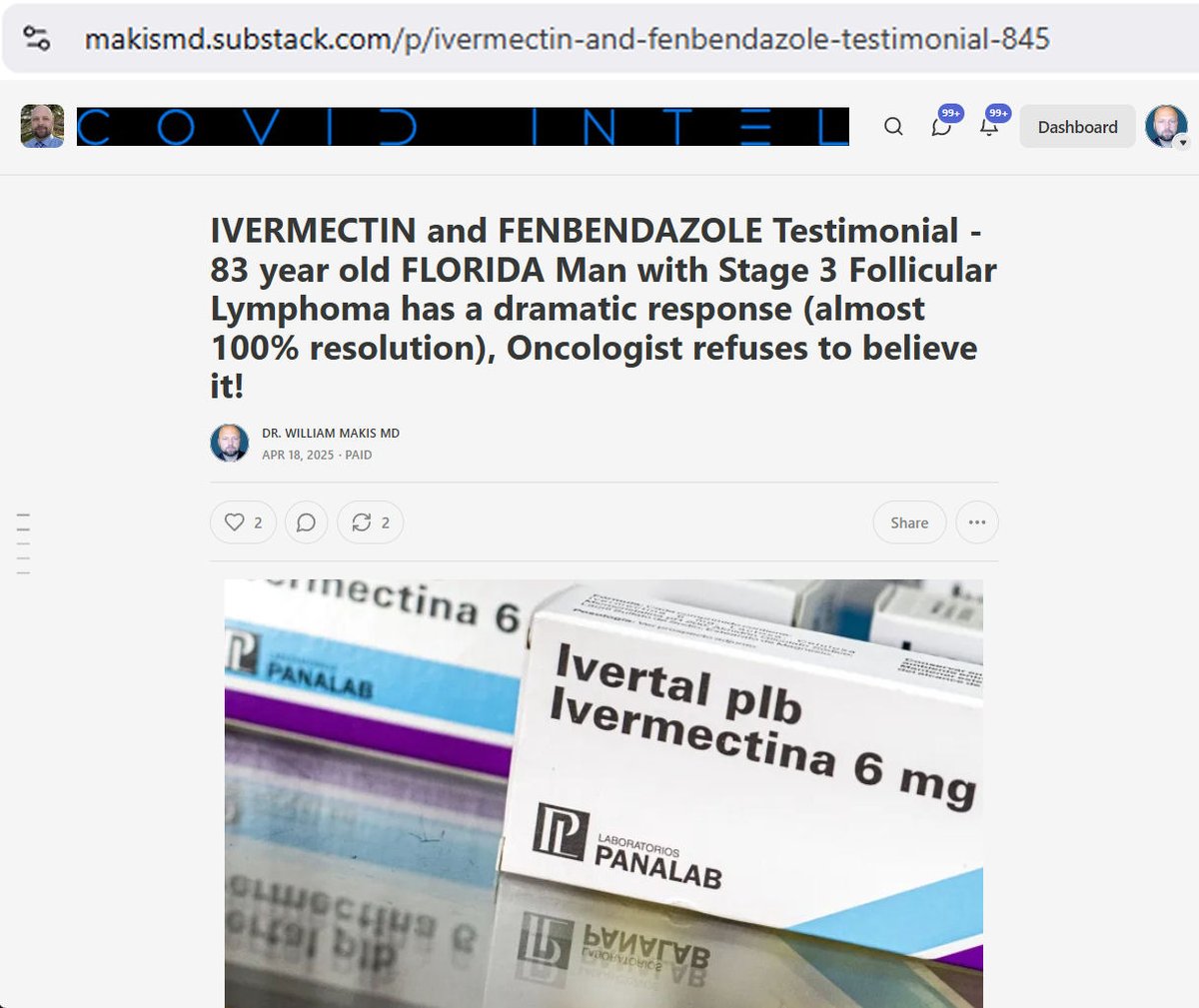 MakisMedicine's tweet photo. NEW ARTICLE: IVERMECTIN and FENBENDAZOLE Testimonial - 83 year old FLORIDA Man with Stage 3 Follicular Lymphoma has a dramatic response (almost 100% resolution), Oncologist refuses to believe it!

This is an incredible story for several reasons, but you'll have to read to the end, to find out 😃

STORY:
83 year old Florida man was diagnosed with extensive Stage 3 Follicular Lymphoma

Oncologist put him on “watch and wait”

Patient came to me in early September 2024.

We started the Makis Ivermectin Cancer Clinic Protocol in early October 2024:

Ivermectin 1mg/kg/day

Fenbendazole 444mg/day

Melatonin 120mg/day

RESULTS after 6 months, on PET/CT (April 2025):

"Dramatic improvement in the lymphadenopathy previously seen in the axillary regions bilaterally. Previously the largest right axillary lymph node at approximately 3.4 x 1.9 cm, currently 1.0 x 0.7 cm. Previous maximum SUV of 9.5, currently 1.3"

"Dramatic improvement in the retroperitoneal adenopathy"

"IMPRESSION: Dramatic improvement of the lymphadenopathy from the neck all the way through the groin. No new or enlarging lymph nodes seen. Only mild activity seen within the right axillary lymph node. Other lymph nodes are not able to be discerned above background significantly improved from the exam September 2024."

My Take:

I have never seen a Radiology report use the word “Dramatic” three times in the same report. And I have seen 10,000s of PET/CT Reports.

Radiologists don’t get emotional with their language.

No chemo. No radiation. Almost all the cancer is gone.

But that’s not the best part of the story.

Best part is the reaction of the Oncologist:

“We discussed findings on PET…which did show improvement in his lymphadenopathy”

“We had extensive discussion about PET imaging”

“Discussed waxing and waning nature of lymphadenopathy”

TRANSLATION:

Waxing and waning = “Cancer comes and goes.”

In other words, the results are random. Yes, 99% of the cancer is gone but it was all coincidence.

He then refused to do a follow-up PET scan in 6 months! Heaven forbid the excellent results would confuse him even more! 🤣

CONCLUSION: This is an incredible story because:

1. No chemo, no radiation, only "watch and wait" from Oncologist

2. 6 months of low dose Ivermectin & Fenbendazole

3. 99% of cancer gone (one mildly active little lymph node remained)

4. Oncologist says cancer comes and goes and attributes the results to coincidence. Chance.

I run the world's largest Ivermectin Cancer Clinic.

I can assure you that when you have "extensive adenopathy from neck through groin" that is Stage 3 Lymphoma (with SUVmax up to 12.0 on PET/CT), 

it doesn't just disappear if you close your eyes and wait.

This Florida Oncologist was so uncomfortable with the excellent results, he won't do a follow-up PET/CT scan. He'd rather close his eyes and pretend. Stay in the dark - it's the world he knows.

But guess what, repurposed drugs like Ivermectin and Fenbendazole are revolutionizing Cancer Care and more and more Oncologists are going to get "uncomfortable" with results they don't comprehend.

And I am here to watch them squirm.

Article Link in photo to avoid shadowban, just re-type the URL in the first photo at the top, into your browser to access.

@joerogan