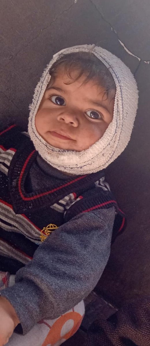 mohammedhatl3's tweet photo. Close-up of Jamal's face showing his eyes. Caption: Behind these brave eyes, a little warrior fights daily. Jamal's smile was stolen by war, but your kindness can help restore his future. Donate now and be his hope. Link in bio. #HopeForJamal #GazaChild https://t.co/hDGTZspcbO