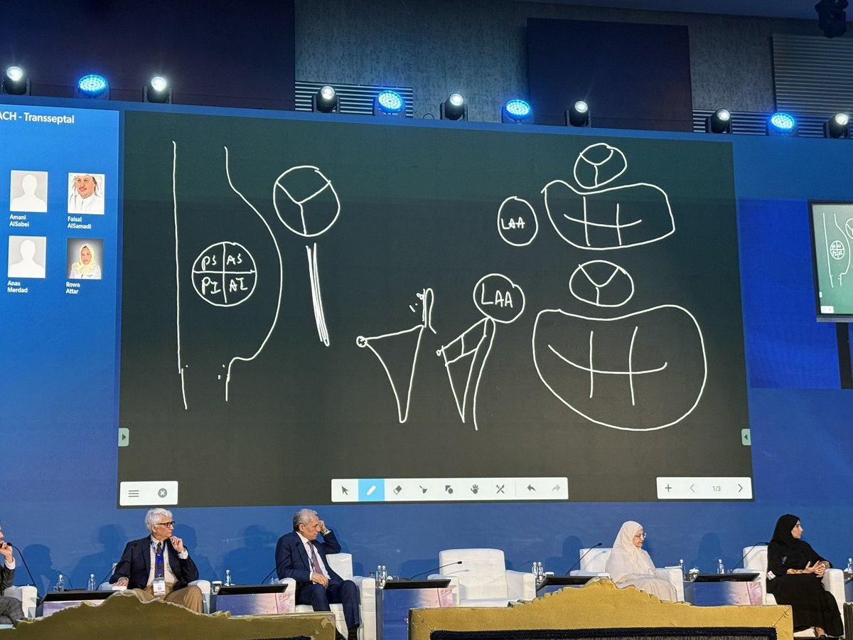 KardiologieHH's tweet image. Amazing #SimulationBasedTraining session
at #TCTMiddleEast2025 on 
#TSP🎯+#LAAO☔️

Host: @adnanalkhouli 

Amazing #Sim1Do1Teach1 team:
@RHAAttar (#EchoFirst)
@MarwanSaadMD (#TSP #LAAO)

At #Simulands Simulator 👍

@mirvatalasnag @drptca @AlkashkariWail @kfaraidy @mmamas1973