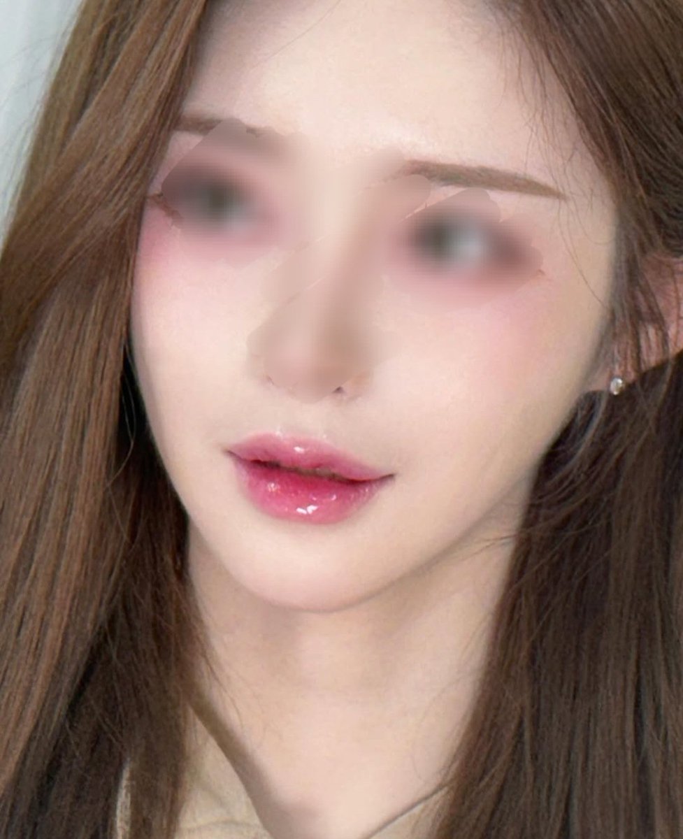 全身麻酔 で手術を受けたので、当日中に退院することができましたし、ドレーン（血抜きの管）も付けなかったので、回復もとても楽でした。
何より、手術前のデザインカウンセリングを先生がとても丁寧にしてくださって、本当に信頼できると感じました。